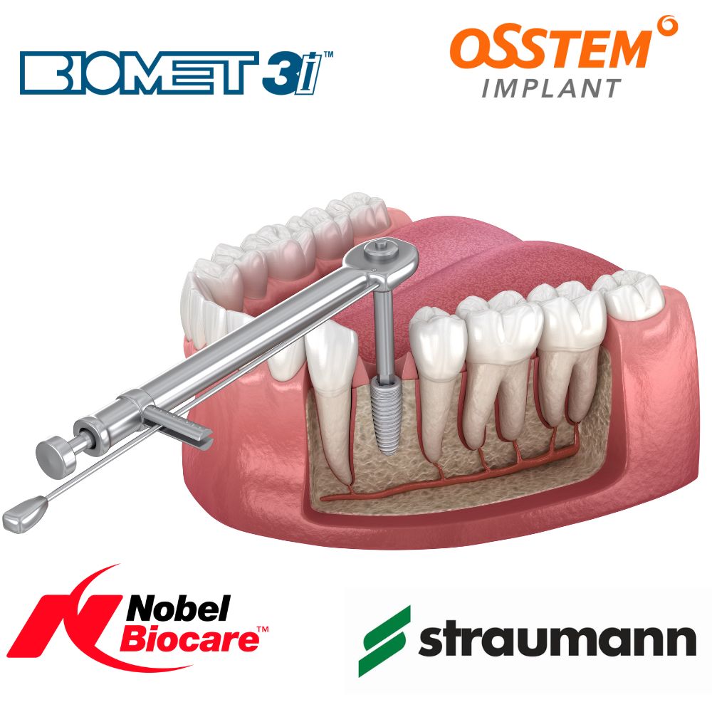 Universal Implant Prosthetic Kit Dental Accessories