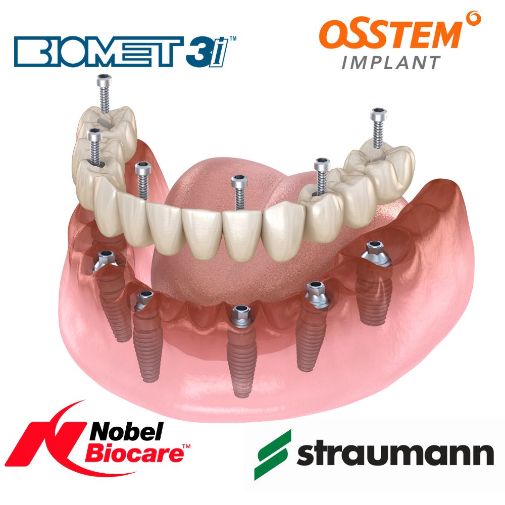 Implant Screw Removal Kit Dental Accessories
